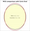 MCG-Corio Oval comparison.jpg
