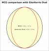 MCG-Glenferrie Oval comparison.jpg